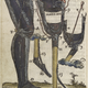 Illustration for article titled The History of Prosthetics Reveals a Long Tradition of Human Cyborgs